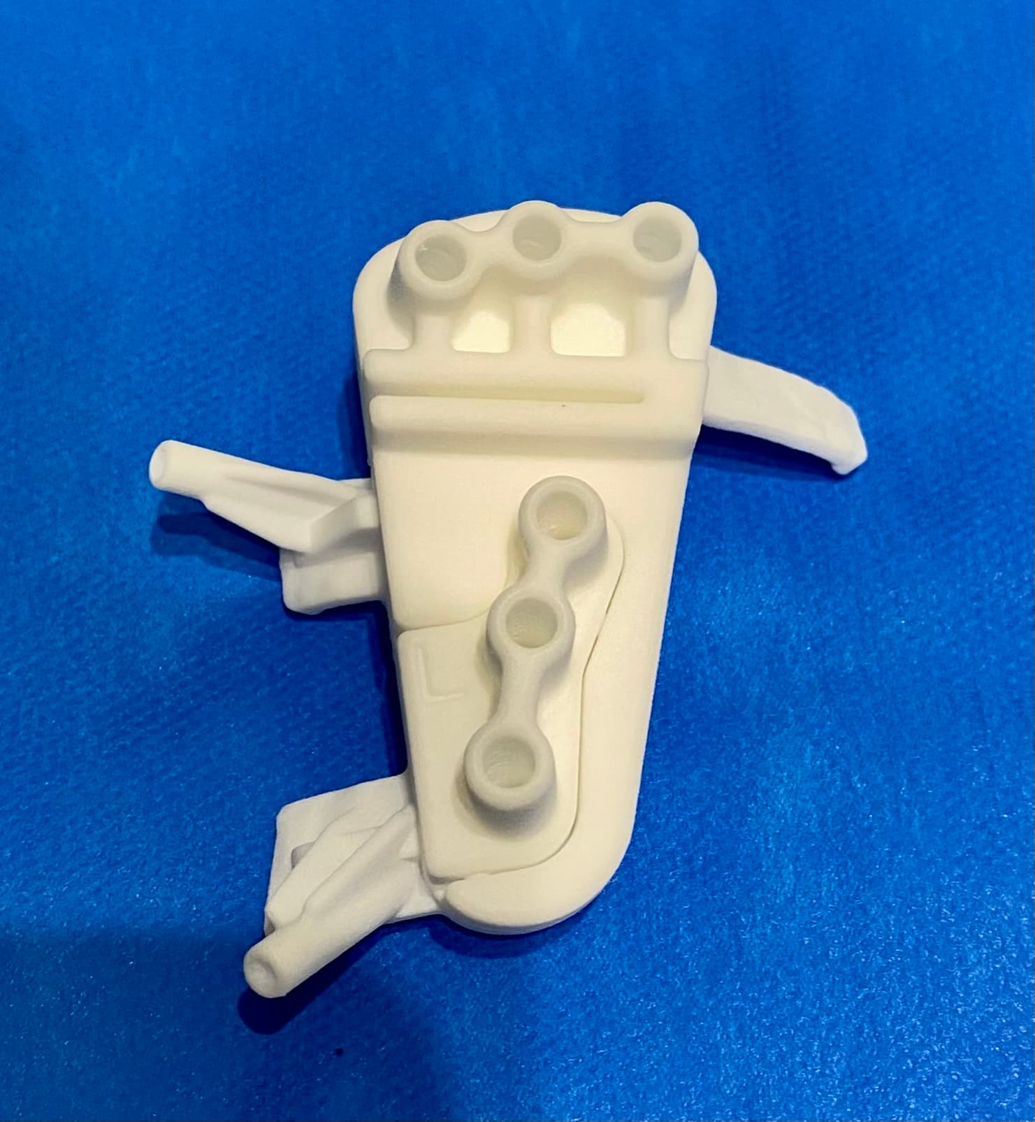 Guide de coupe sur mesure imprimé en 3D — ostéotomie tibiale