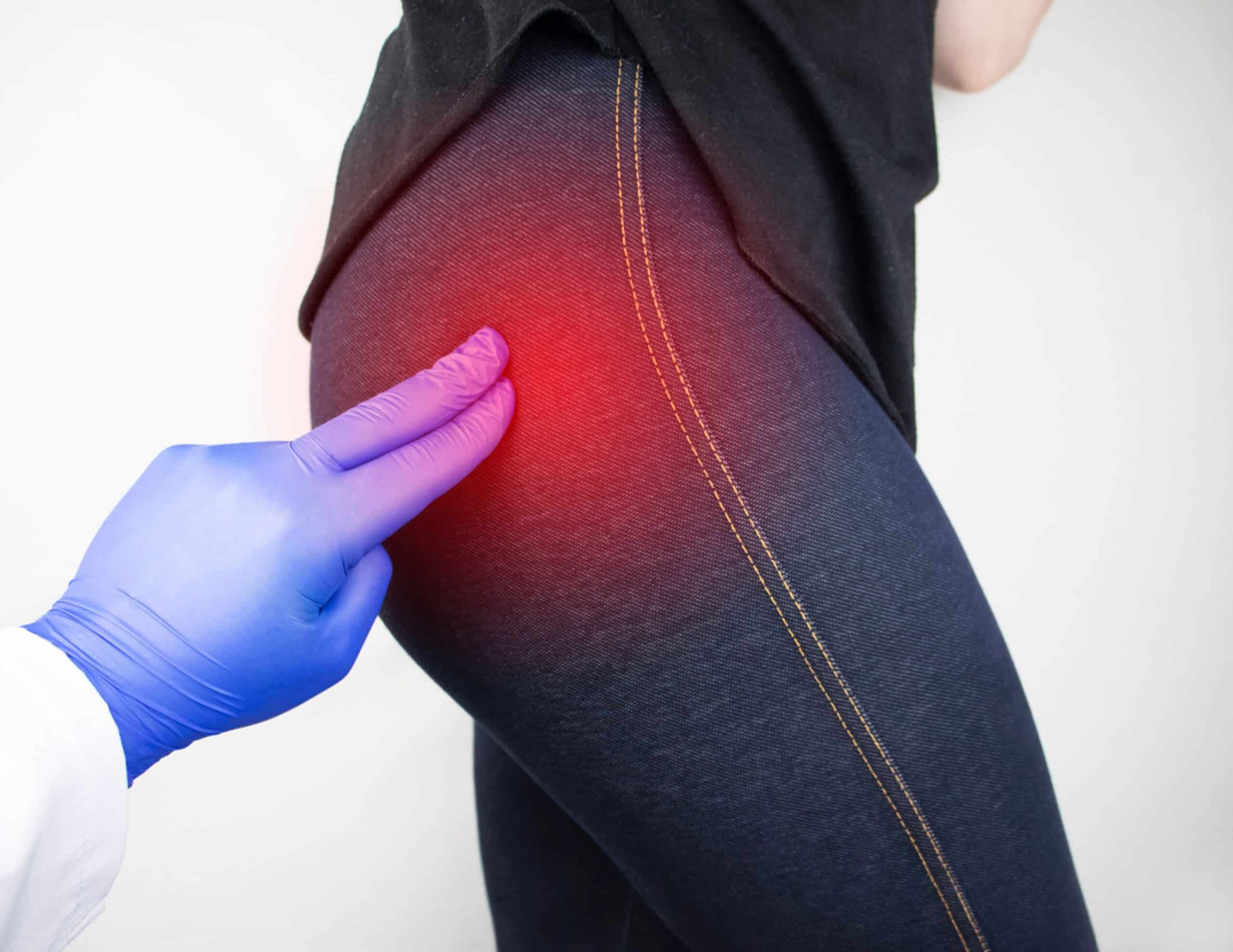 Patient présentant une douleur après prothèse de hanche